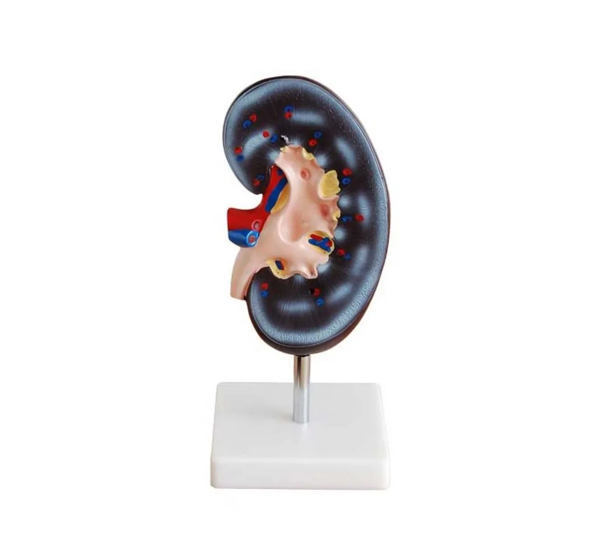 

Anatomical Model of Kidney, Kidney Model