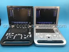 Promotion 3D function portable ultrasonography machine cheap price