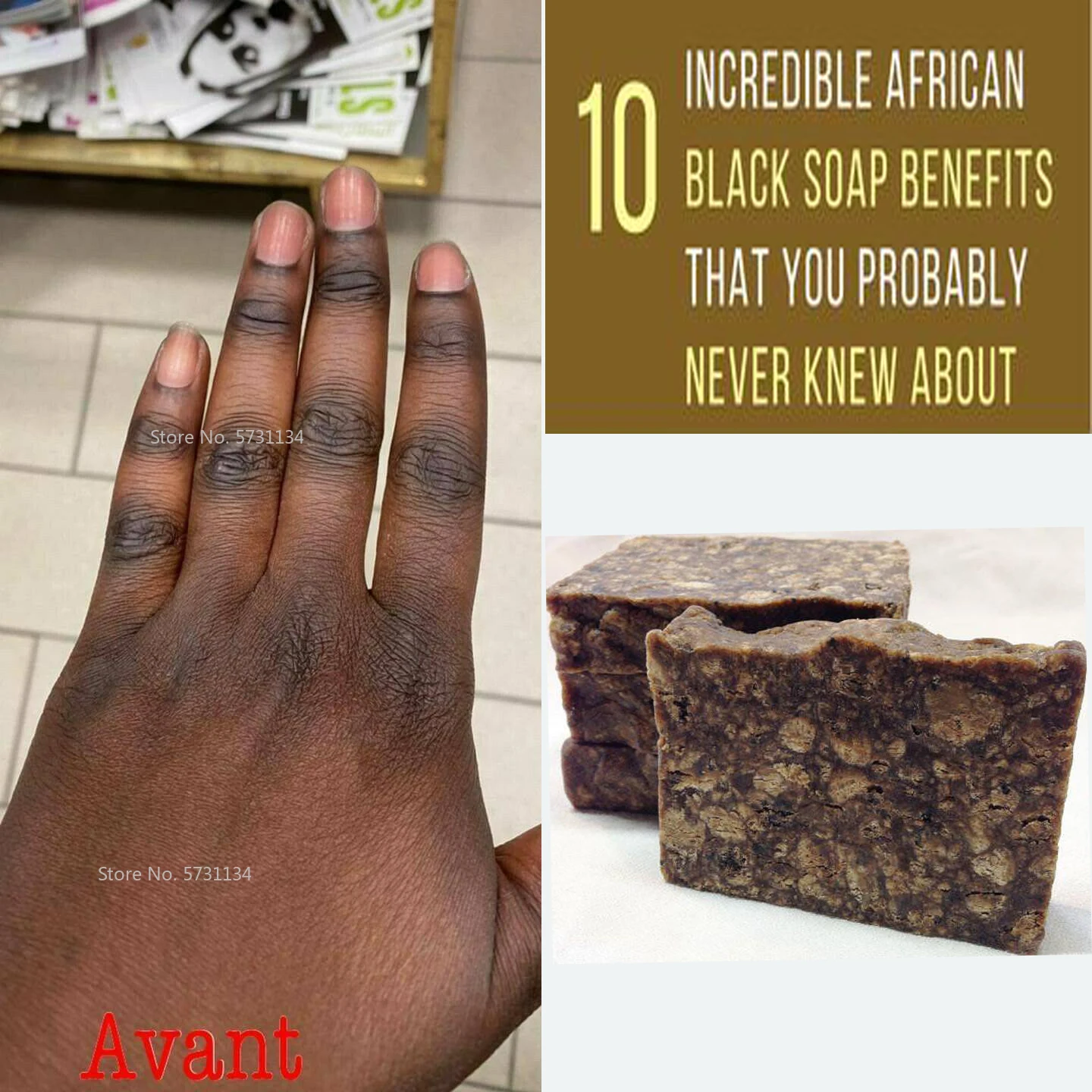 Natural 100% Raw African Black Soap Magic Anti Taches Rebelles Beauty Bath Body Treatment Acne Skin
