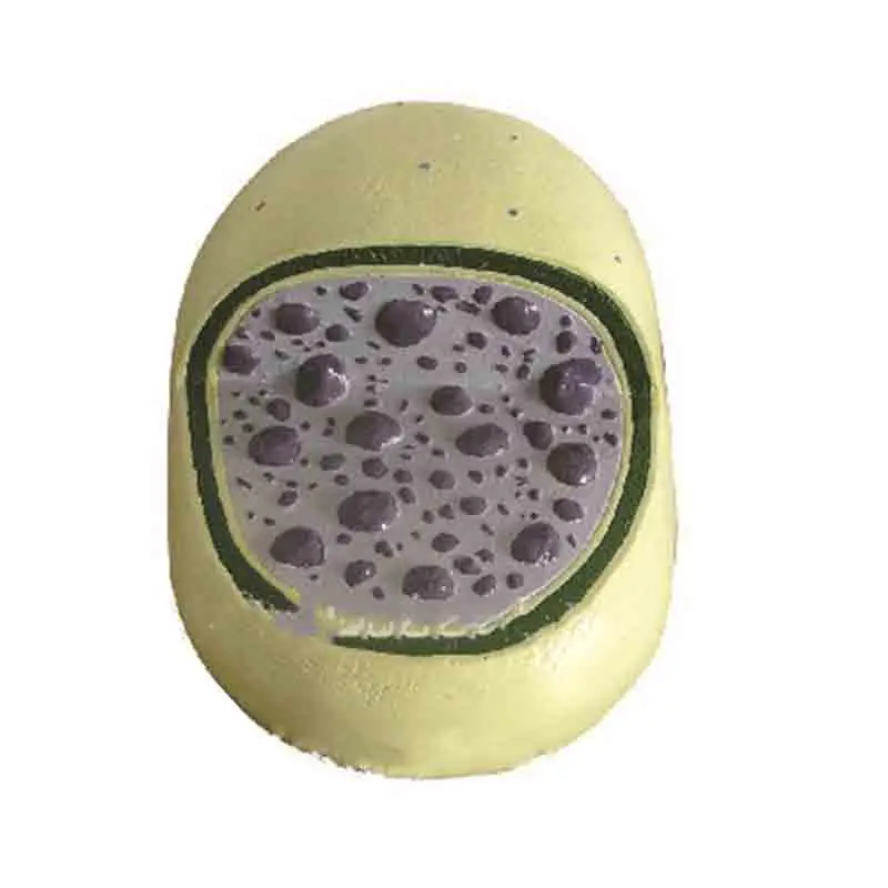 

Lysosomal amplification model