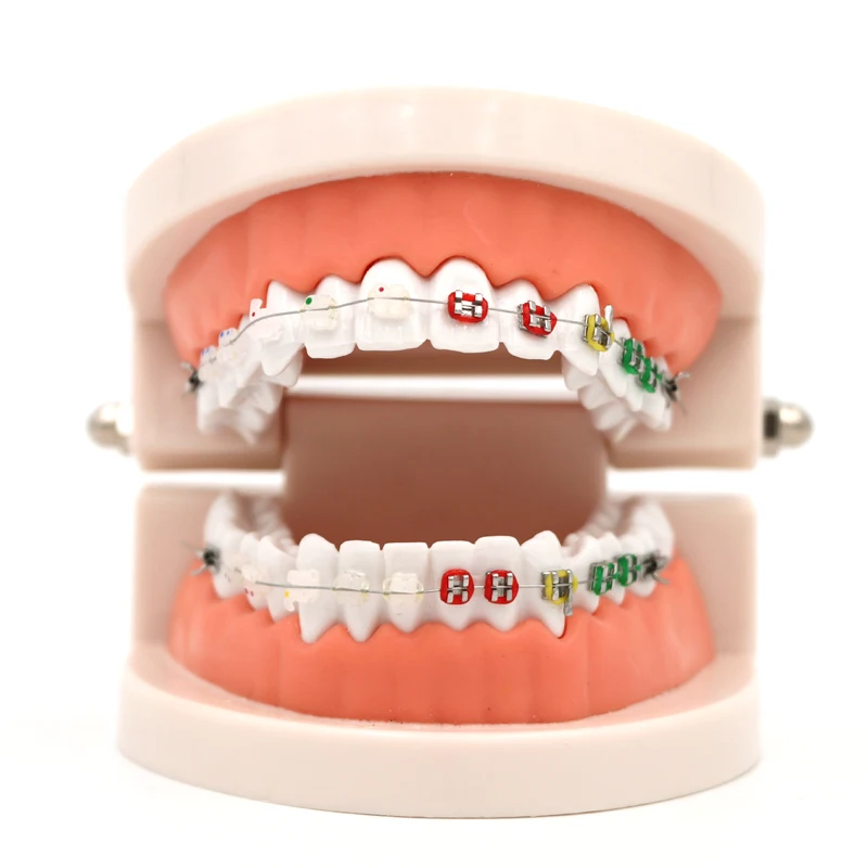 1pc Dental ortodontyczne leczenie Model z uchwytem ceramicznym Arch Wire Ortho Metal ortodontyczne protezy zębate Model