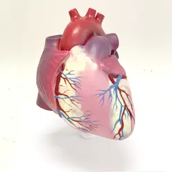 Human Atherosclerosis Thrombosis Heart Disease Model Anatomy Heart Structure Internal Pathology Visceral Heart Valve