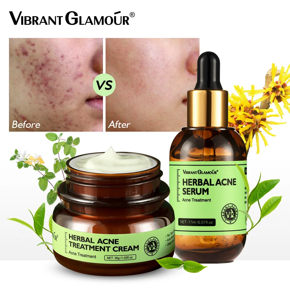 VIBRANT GLAMOUR  Herbal Facial Skin Care Set Face Cream Serum Acne Treatment Oil Control Get Rid of Acne Marks Brighten 2PCS