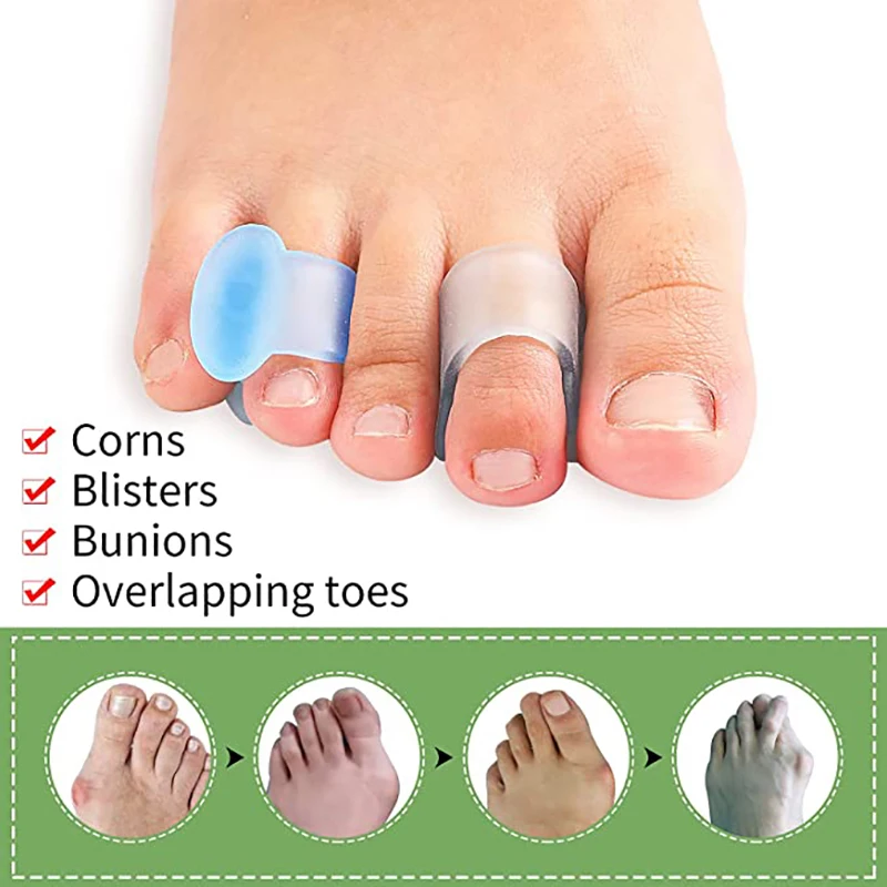 4pcs Silicone Finger Toe Separator Hammer Toe Correction Pad Hallux Valgus Orthopedic Bunion Guard Toe Spacer Foot Care Tool