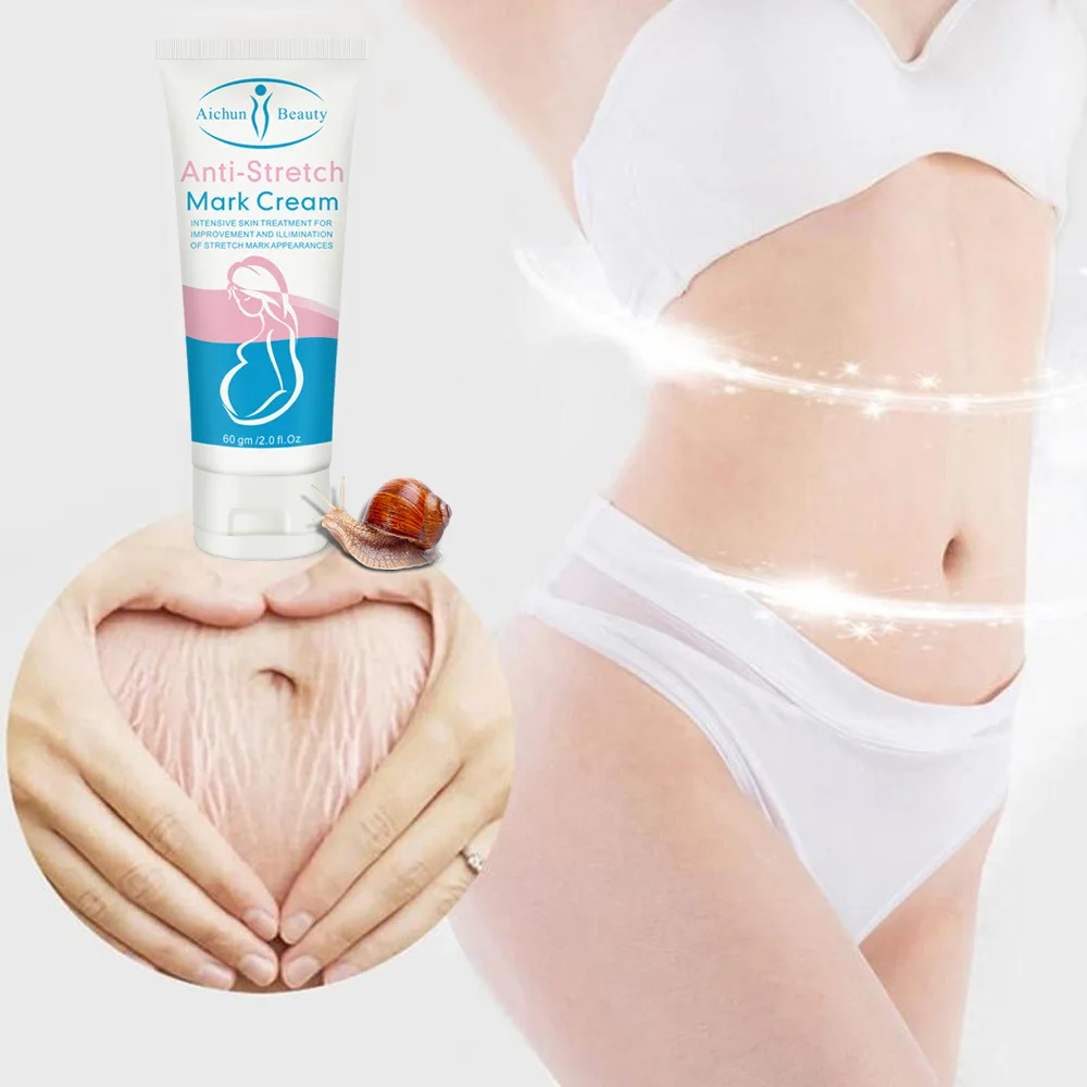 Remove Stretch Mark Cream Snail Extract Anti-fine lines Firming Skin Cream For Maternity Slackline Pregnant Cream