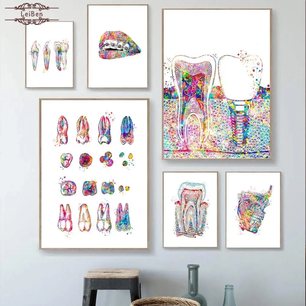 Oral Health Colored Teeth Poster Dental Implant Anatomy Canvas Painting Medical Wall Art Pictures for Hospital Clinic Decor