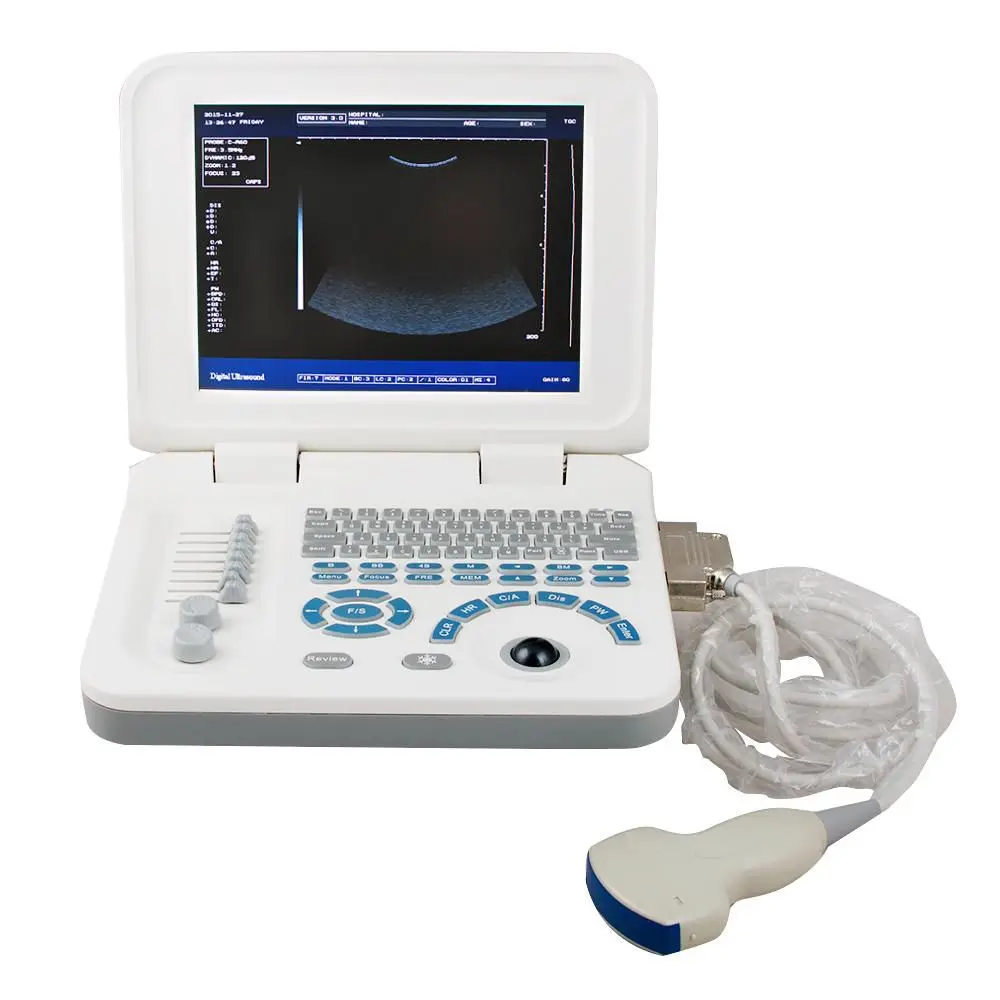 New Good Quality 10 Inch LED Screen Notebook Portable Ultrasound Scanner Machine