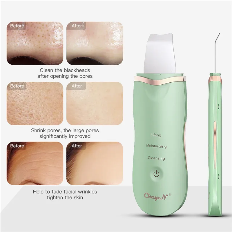 CkeyiN Scrubber per la pelle del viso ad ultrasuoni professionale Ion Deep Face Cleaning Peeling dispositivo ricaricabile per la cura della pelle Beauty Decive