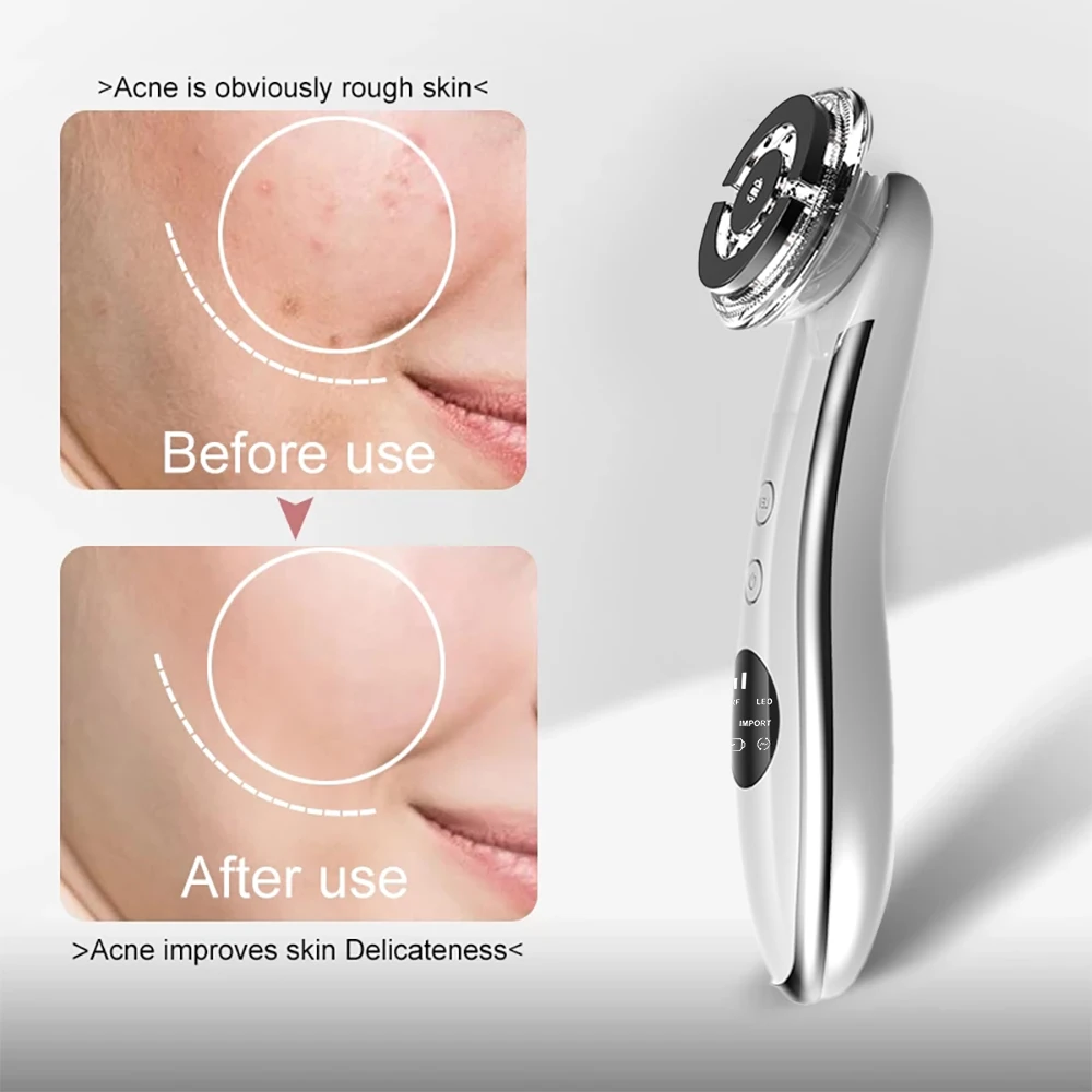 EMS Face Massager วิทยุ Mesotherapy Skin Rejuvenation Facial Lifting ความงามกำจัดริ้วรอยคลื่นวิทยุ Skin Care