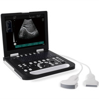 15 Inch Portable Notebook USG Ultrasound Scanner Machine