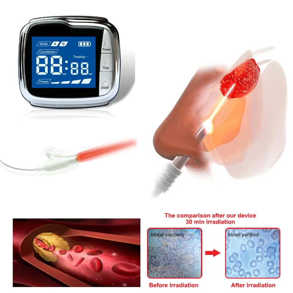 Terapia terapeutica dell'orologio laser Terapia Tinnito Infezione dell'orecchio Perdita dell'udito Otite Media Orologio laser Tinnito Fisioterapia LLLT 650nm