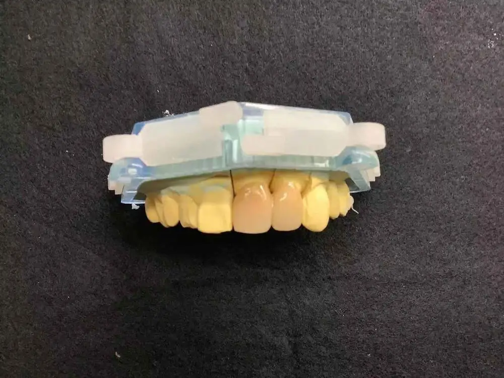 Vasden A2 Kleur Ce/Iso/Fda Multilayer Zirconia Tandheelkundige Blokken/Zirconia Blanks/Schijven Voor Cad Cam open Systeem