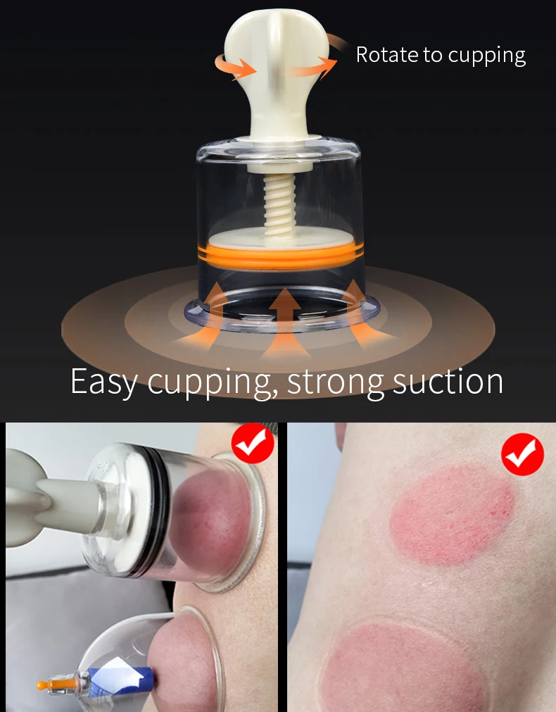 Chinese Cupping Therapy Rotating Handle Cupping Vacuum Cupping Cup Body Massager Vacuum Suction Enhancer Cup Anti Cellulite