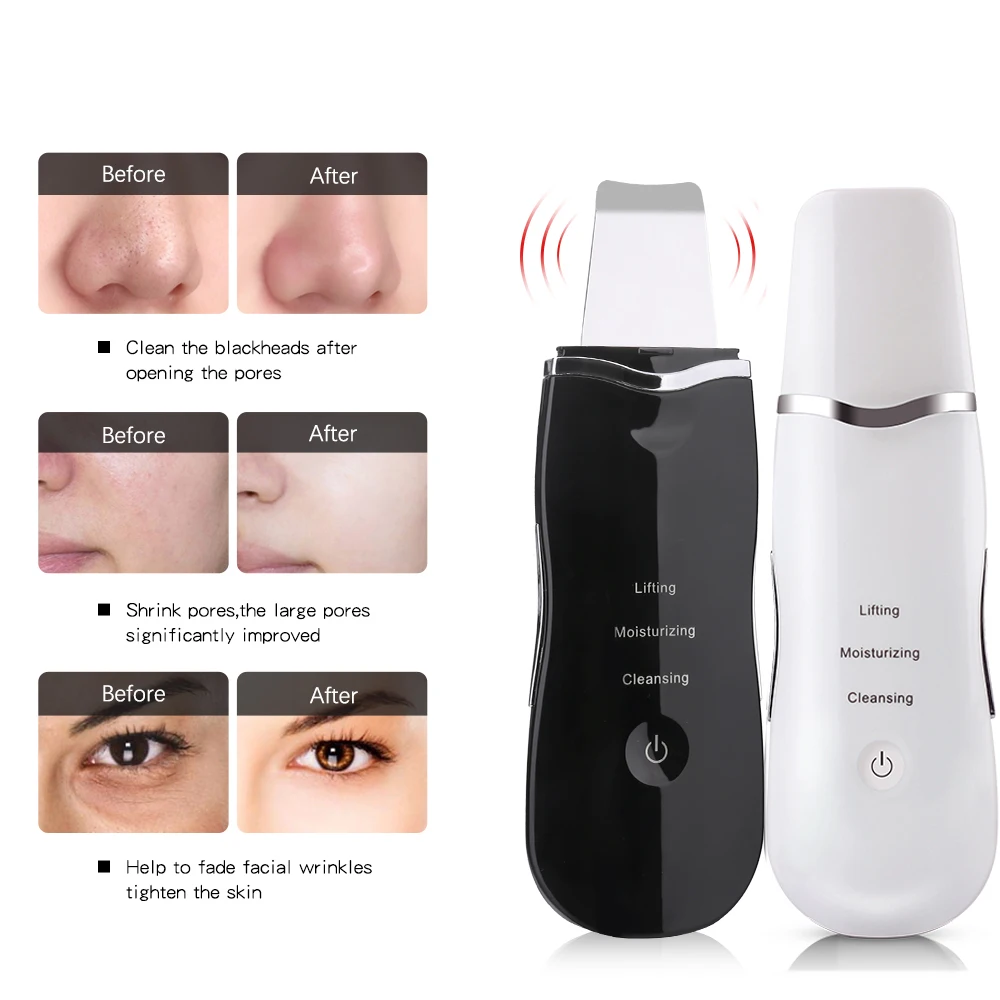 Rechargeable Ultrasonic Face Cleaning Skin Scrubber Cleanser Vibration Blackhead Removal Facial Pore Peeling Ultrasound machine