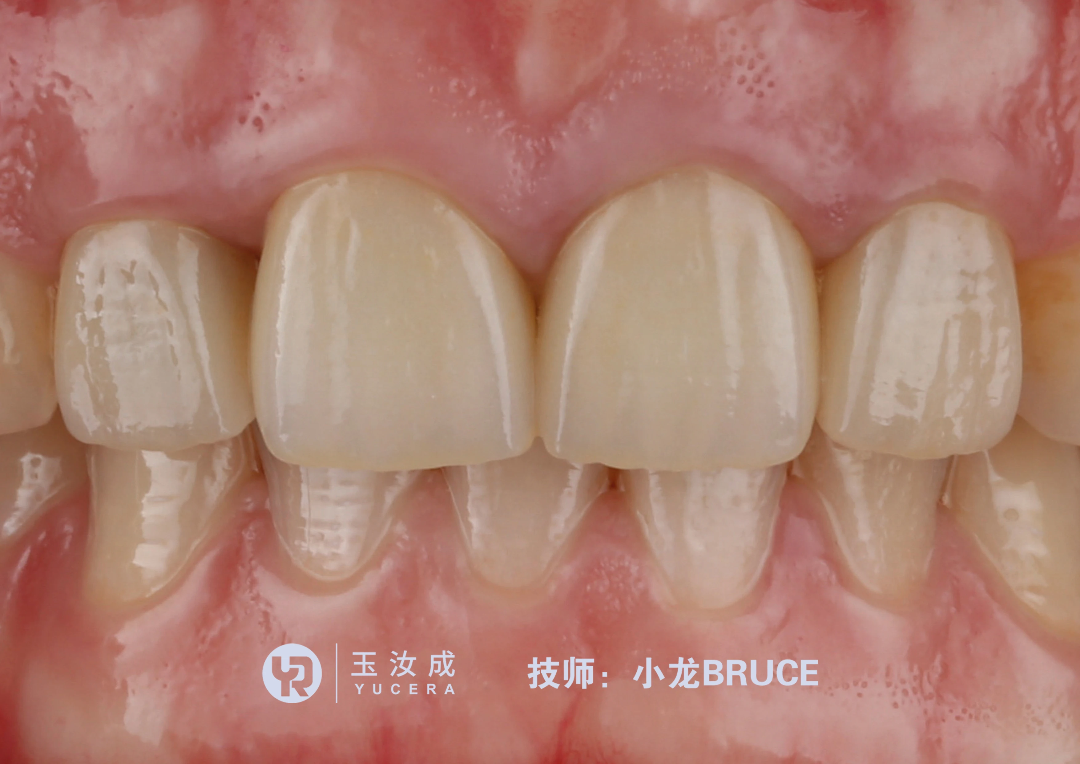 98X16MM 3D Zirconia บล็อกทันตกรรม 57% Transluceny 3D Pro Zirconia บล็อกเปล่าความแข็งแรงในการดัดสูงสําหรับคลินิกทันตกรรมและ Lab