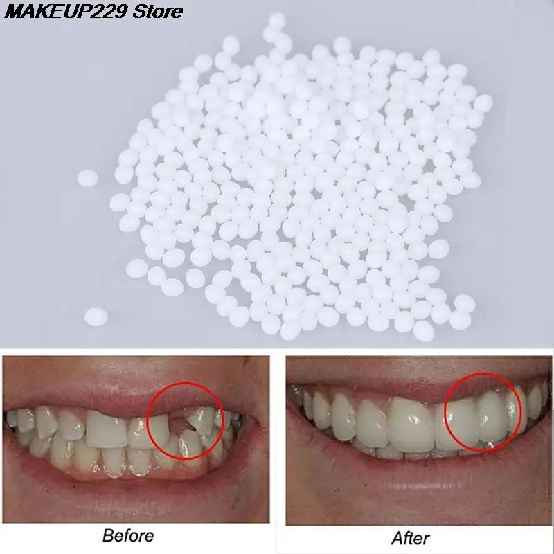 Temporary Tooth Repair Kit Teeth And Gaps FalseTeeth Solid Glue Denture Adhesive Teeth Whitening Tooth Beauty Tool 5/10/15/20g