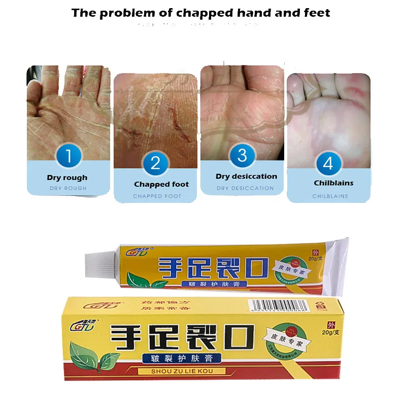 

Original Chinese Cosmetics Hand Foot Crack Cream Peeling Repair Heel Chapped Anti Dry Crack Ointment Exfoliating Foot Cream