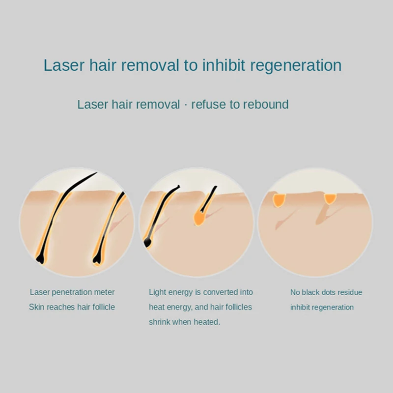 LCD Permanen 990000 Berkedip Baru Laser Epilator IPL Photoepilator Laser Penghilang Rambut Depiladora Cukur Elektrik Tanpa Rasa Sakit