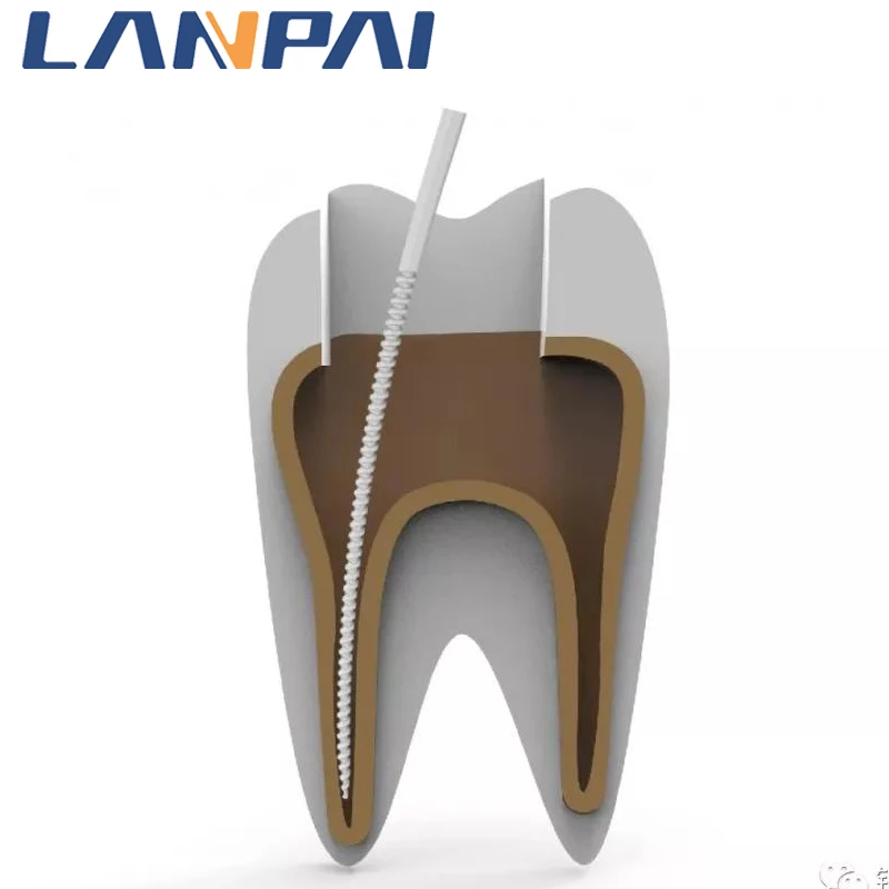 Lanpai Dental Ultrasound Scaler Excavator Maxpiezo With Free Work Tips And Light Dental Ultrasonic Scaler Dentistry Equipment