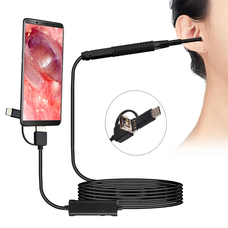 AN103 3.9MM Lente Otoscopio Digital HD720P: La Mejor Cámara Endoscópica para Exámenes Médicos en Casa