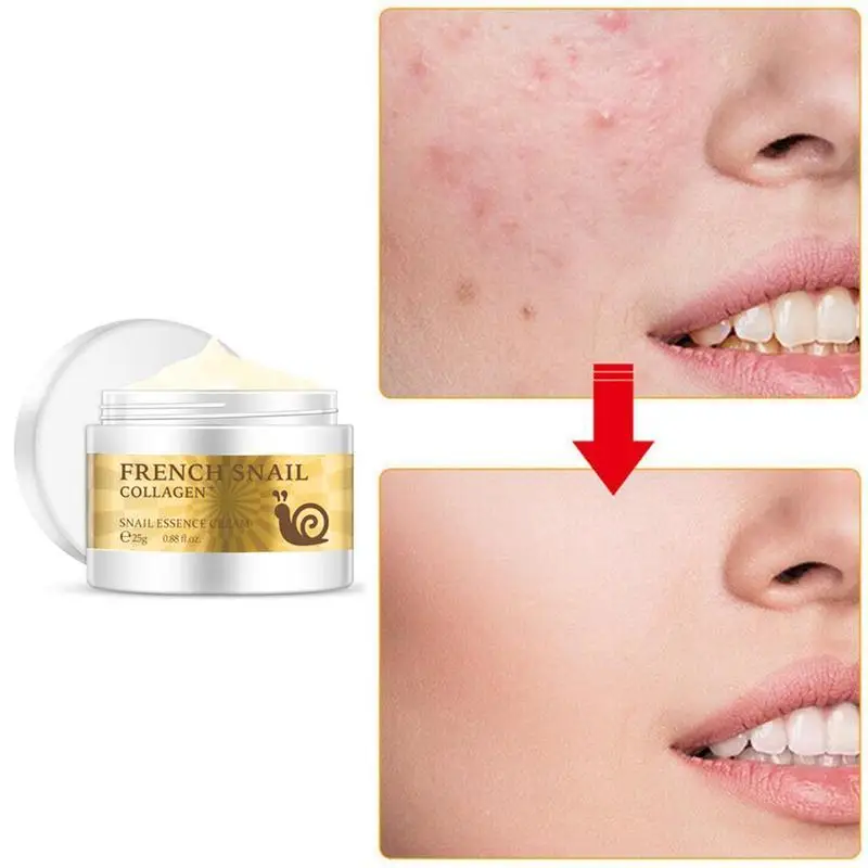 Health Snail Cream Hyaluronic Acid Moisturizing Anti Anti Aging Nourishing Serum Collagen Day Cream Repair Dry Skin