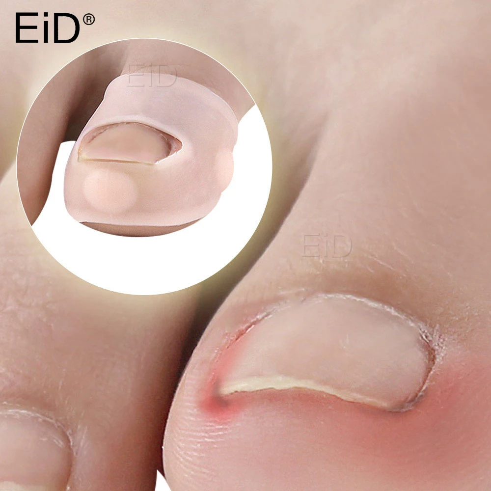 2pcs Big Toe Protector Thumb Care Silicone Soft Breathable Foot Corns Blisters Toe Cap Cover Health Care Blister Toe Separator