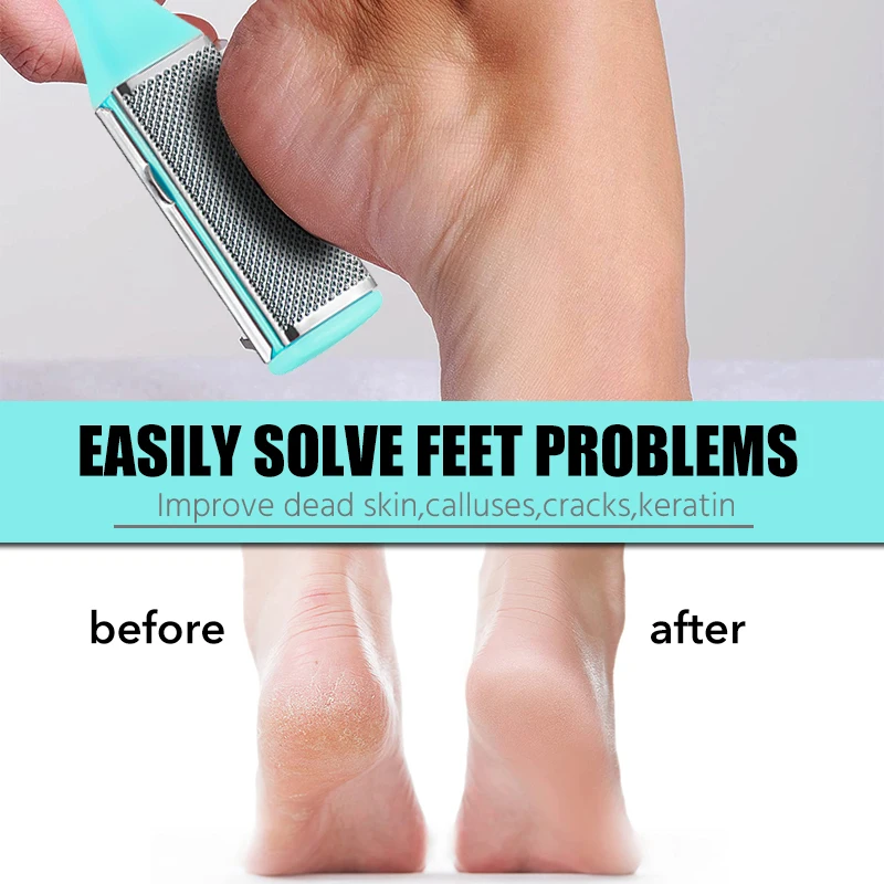 Heel Clean Pedicure Tools Callus Remover Foot Scrubber Foot File and Callus Remover Feet Massage Brush Manicure Foot Care Tools