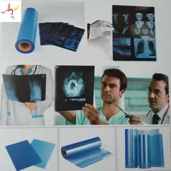 175 Microns Blue Inkjet Medical Film for EPSON CANON HP and All Kinds Printer Used As  X-Ray CT CR DR MR and PET-CT