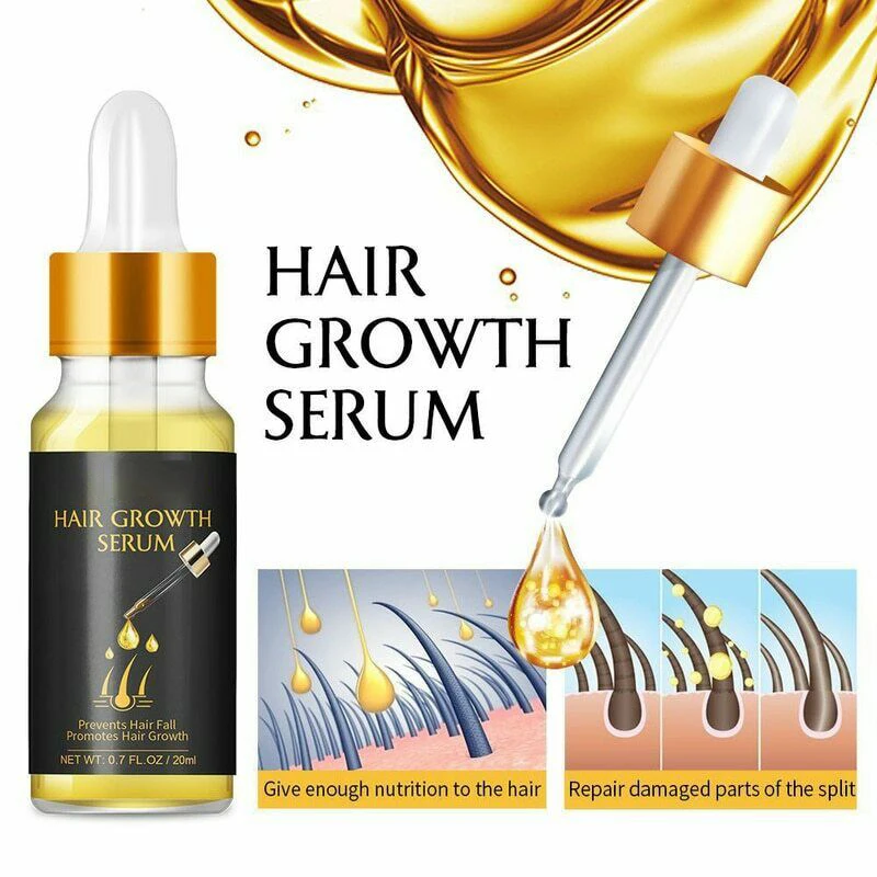20ML Ginger Fast Hair Growth Serum Hair Loss Treatment Essential Oil Prevention Liquid for Hair Regrowth Thicker Longer Stronger