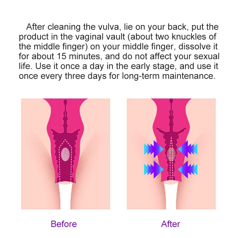 10pcs/box Vagina Tightening Stimulator Chka Wand Shrink Female Hygiene Private Care Repair Stick Narrowing Vagina Dropshipping