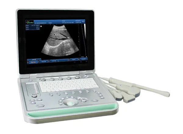 15 in LED screen notebook ultrasound free shipping