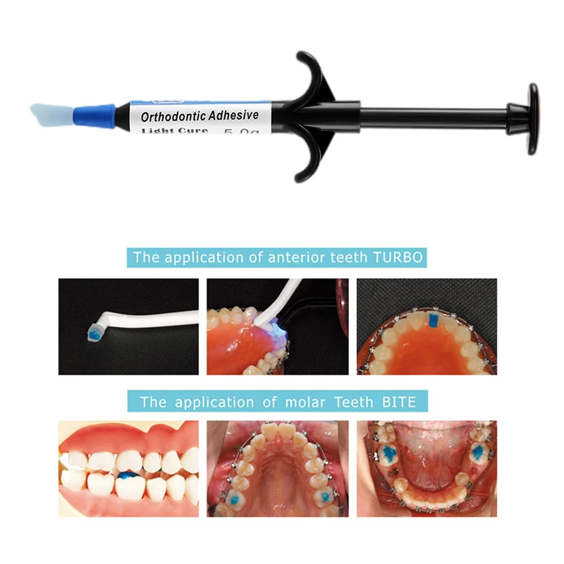 Dental Orthodontic Mini Mold Bite Ramp Forms Lingual Button Traction Hook Injection Mould Blue Adhesive Bonding Glue Brackets