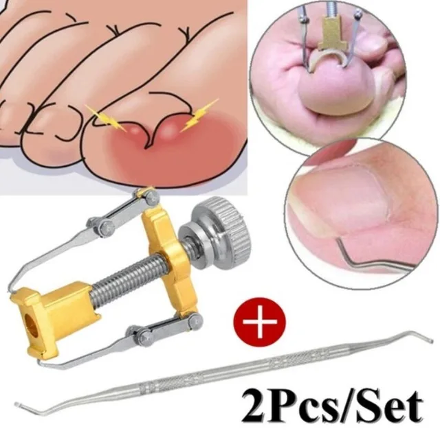 Pedicure tools professional ingrown Toe Nail Correction Nippers Clipper Cutter Dead Skin Dirt Remover + Paronychia Pedicure