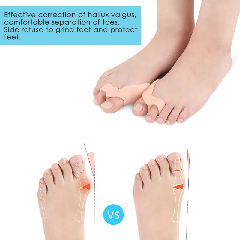 2Pcs Silicone Big Toe Separator Bunion Adjuster Hallux Valgus Toe Straightener Corrector Gel Foot Fingers Pedicure Feet Tool