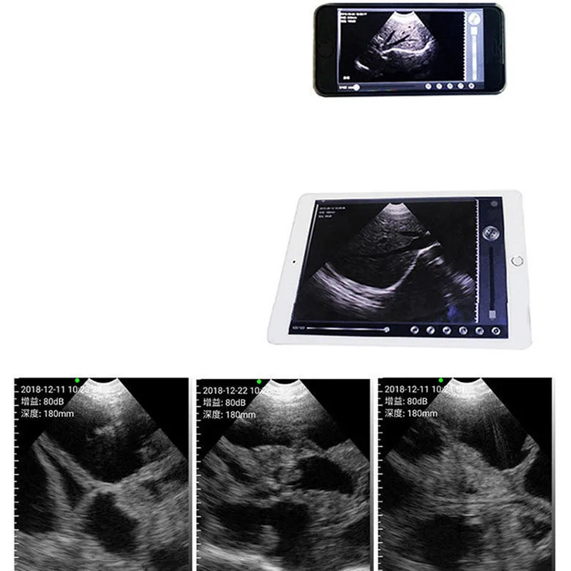 Imagem -04 - Elemento Eletrônica Scanner de Ultrassom Veterinário sem Fio Portátil Teste de Gravidez Handheld Máquina de Ultrassom Porco Ovelhas 64