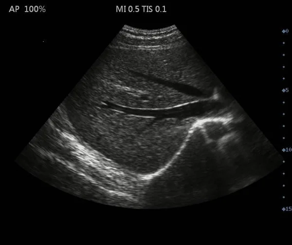 O super preto e branco portátil de b, cabeça convexa da ponta de prova da disposição de 3.5mhz, pode ser equipado com a ponta de prova do ultrassom de 6.5mhz yin