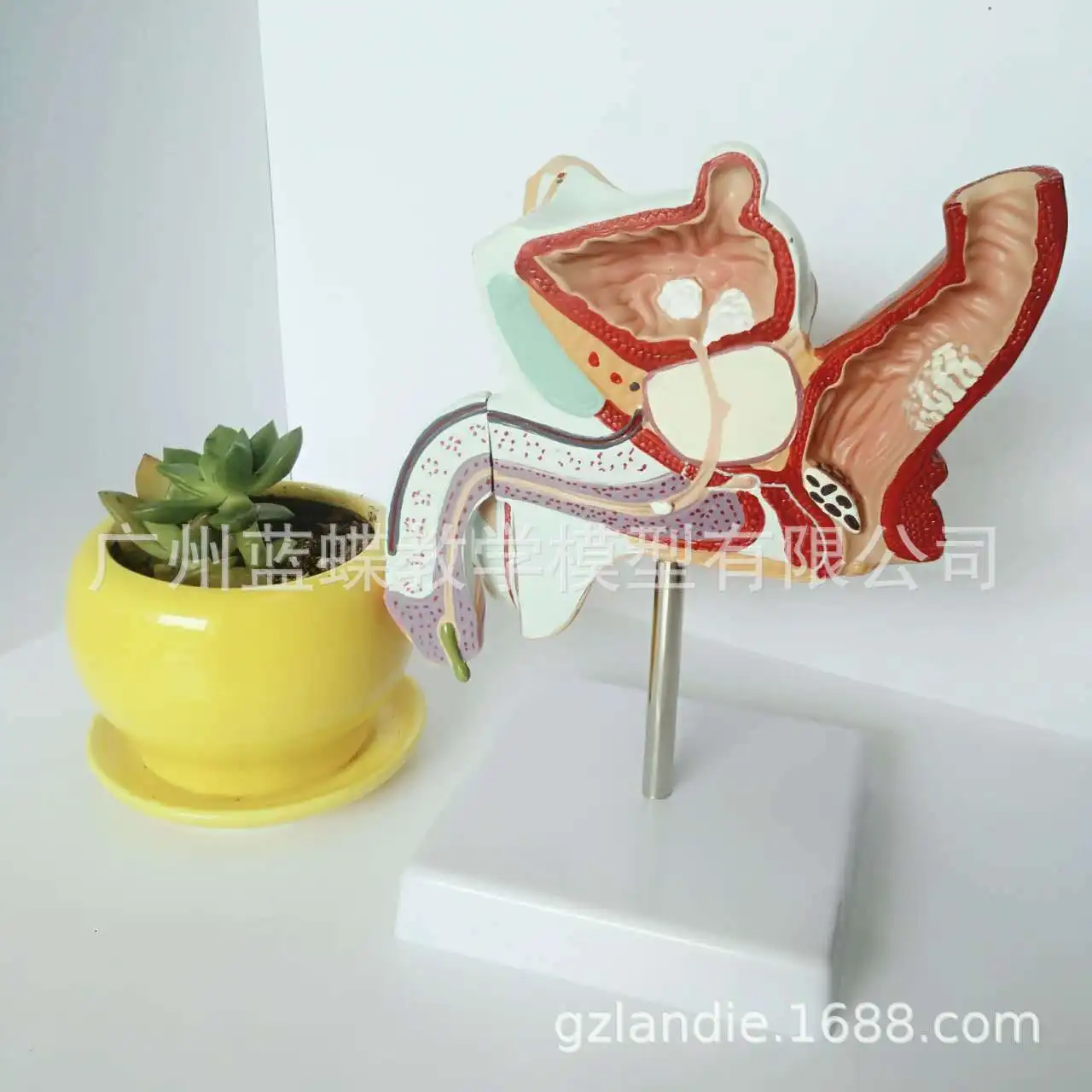 1:1 Life Size Human Male Internal Reproductive Pathology Lesion Anatomical Urinary System  Medical  Disease Model