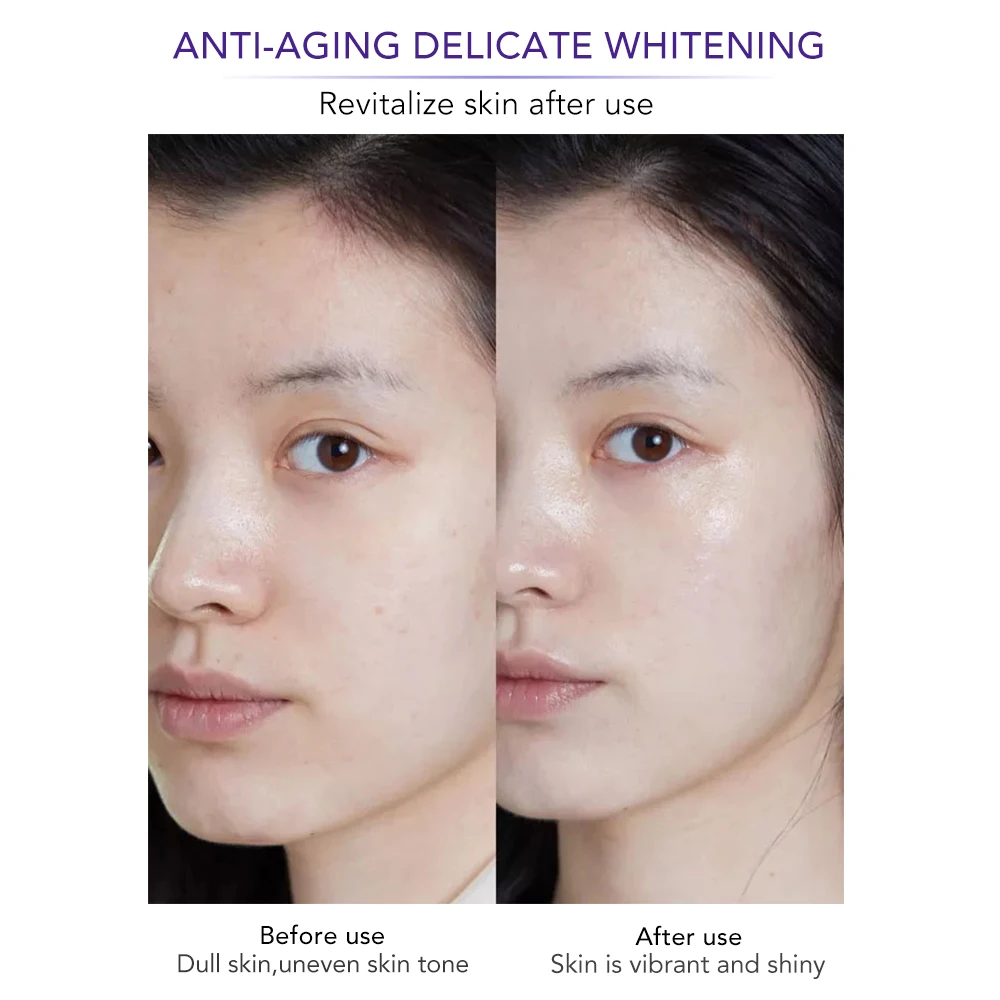 AILKE Whiten Anti-Wrinkle Freckle Face Cream, With Collagen Hyaluronic Acid, Women Korean Facial Moisturizing Set