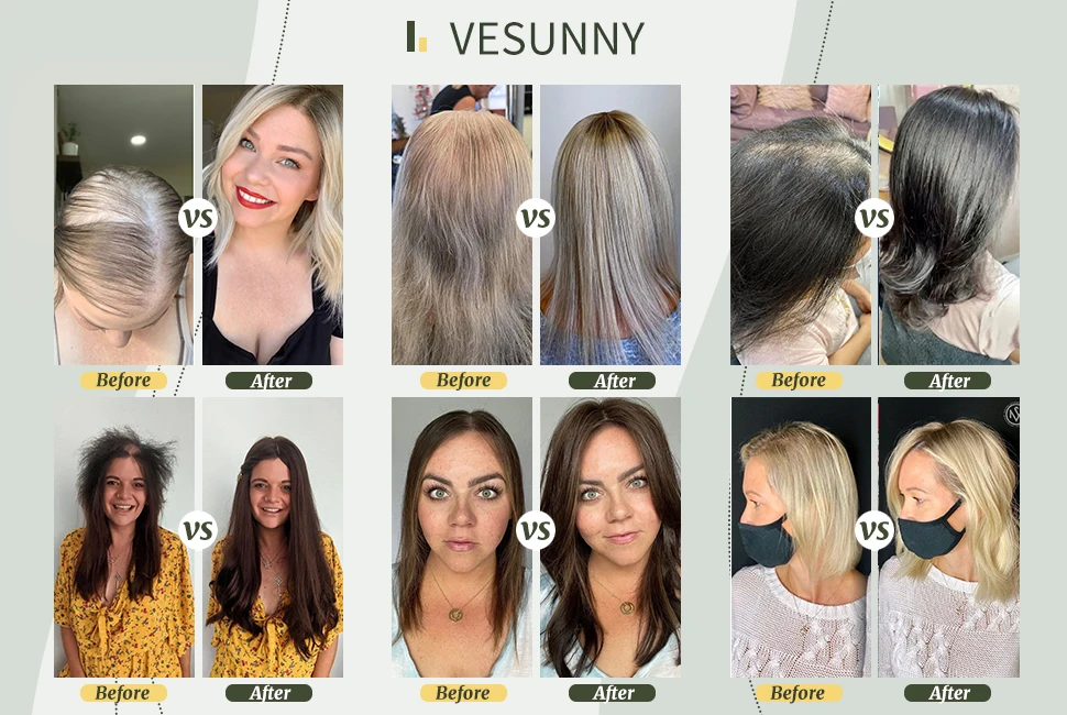 VeSunny Haaraufsatz, 13 cm x 13 cm, Mono-Basis-Haarteile, glattes Remy-Haar, Highlight- und Balayage-Farbe, 100 % natürliches brasilianisches Haar – Detail 4