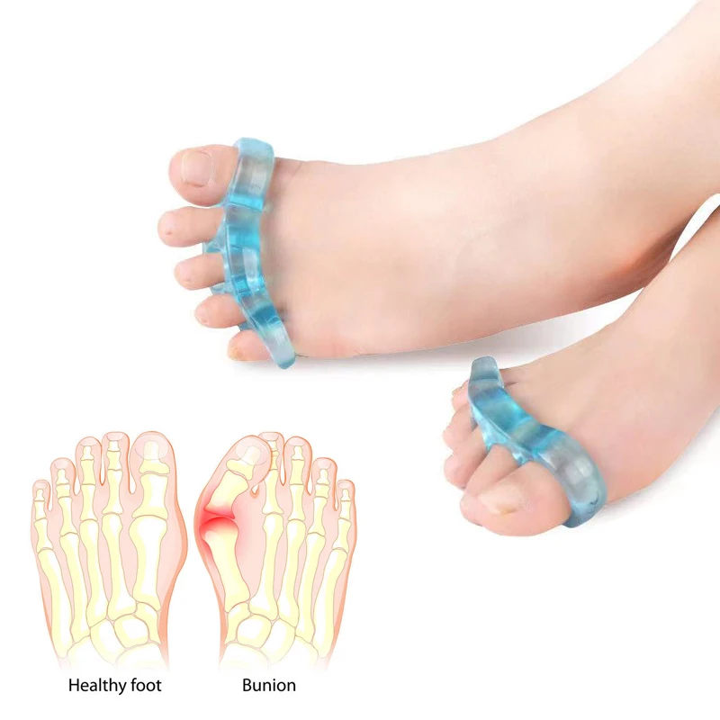 1 Pair Overlapping Toe Separator Adjusters Hallux Valgus Bunion Orthosis Foot Bones Thumb Fixe Correct Feet Care Pedicure Tool