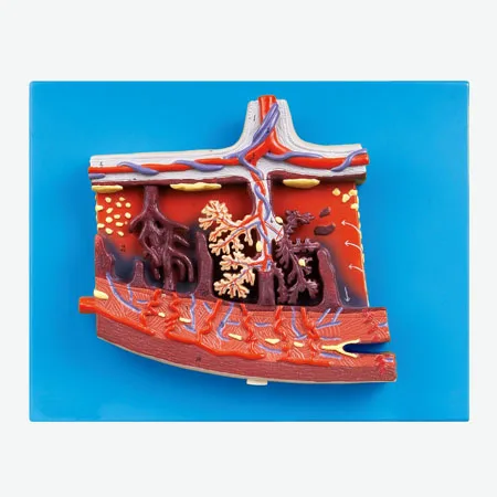 

Enlarged Anatomical model of placenta and placenta tissue