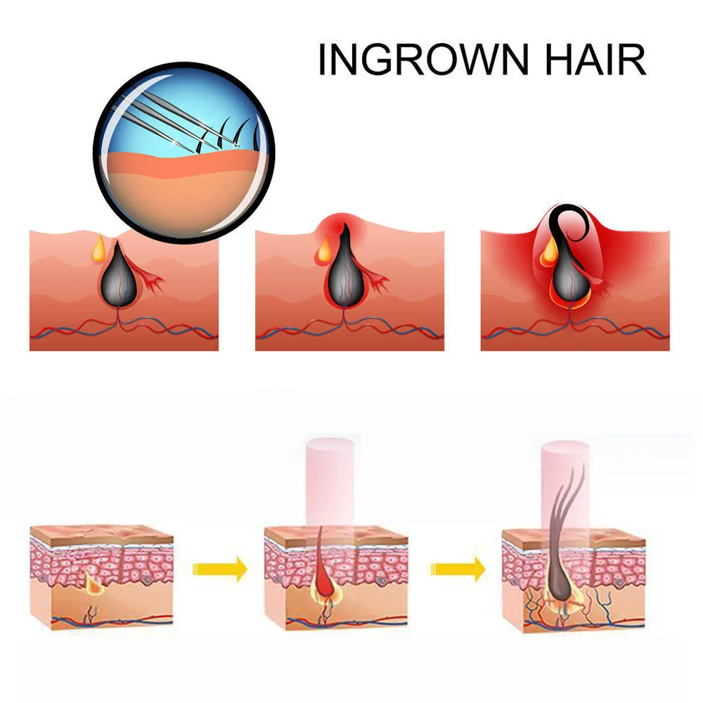 نمو الشعر قبعة إعادة نمو الشعر LED غطاء للشعر أجهزة نمو الشعر العلاج تنمو تساقط الشعر تقليل تساقط الشعر منتجات نمو الشعر