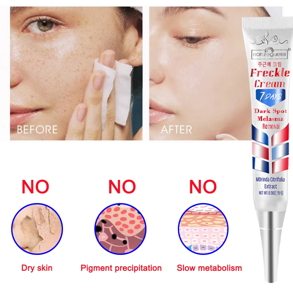 Instant Whitening Freckle Cream Face Treatment Remove Dark Spots Melasma Pigment Melanin Acne Spot Skin Care Korean Cosmetics