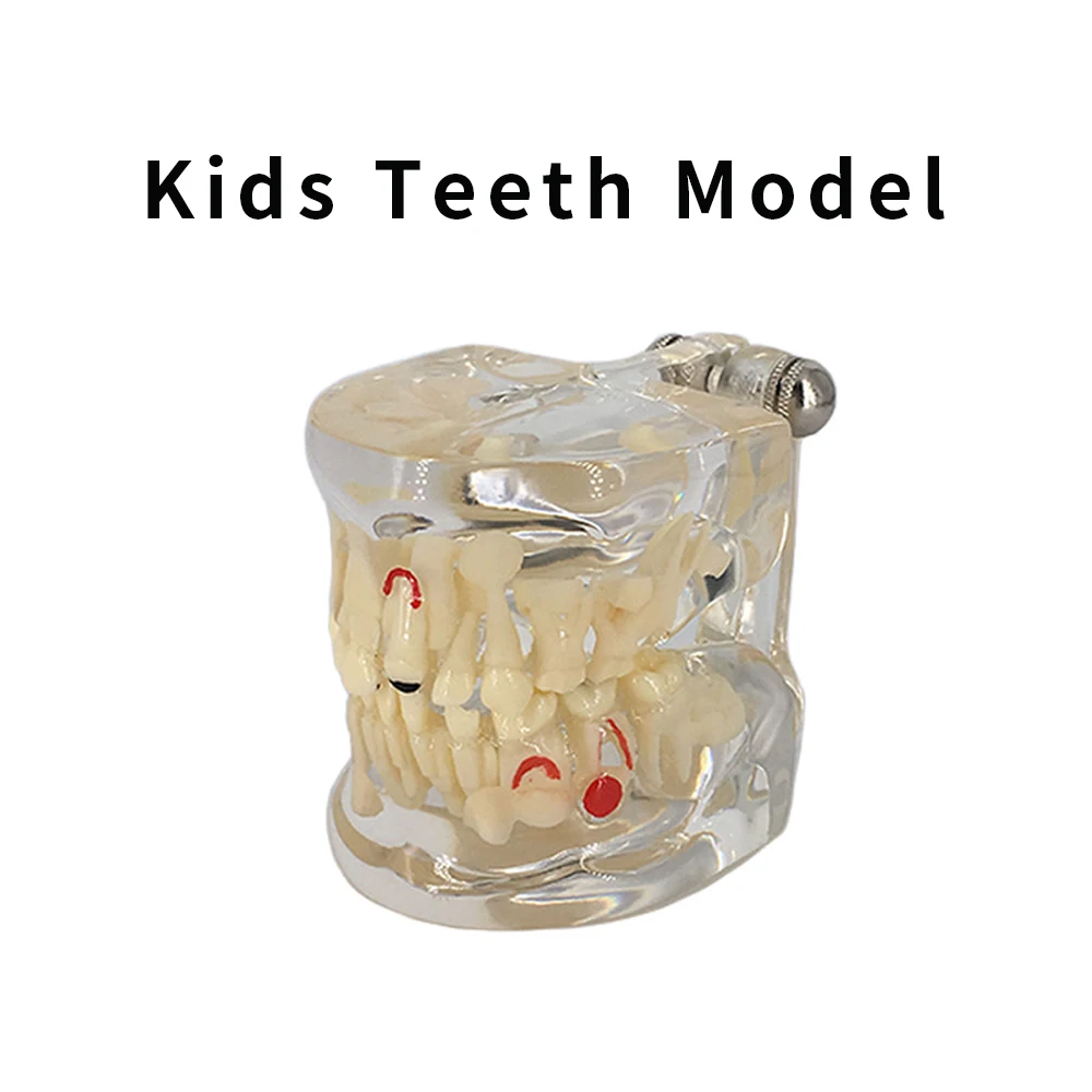 Dental Model Teeth Teaching Model ag3 Kids Transparent Milk Primary Dentistry Tools Supplies Dentist Studying Pediatric Model