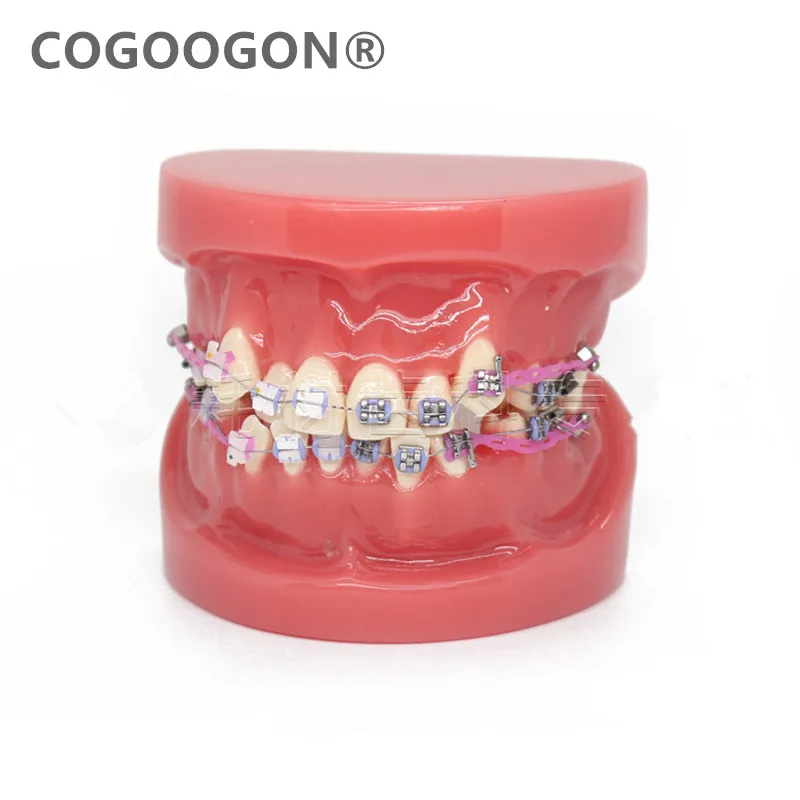 

New Dental Orthodontic Treatment Malocclusion Model With Ceramic Brackets Chain Wire For Medical Science Teaching 2018 New