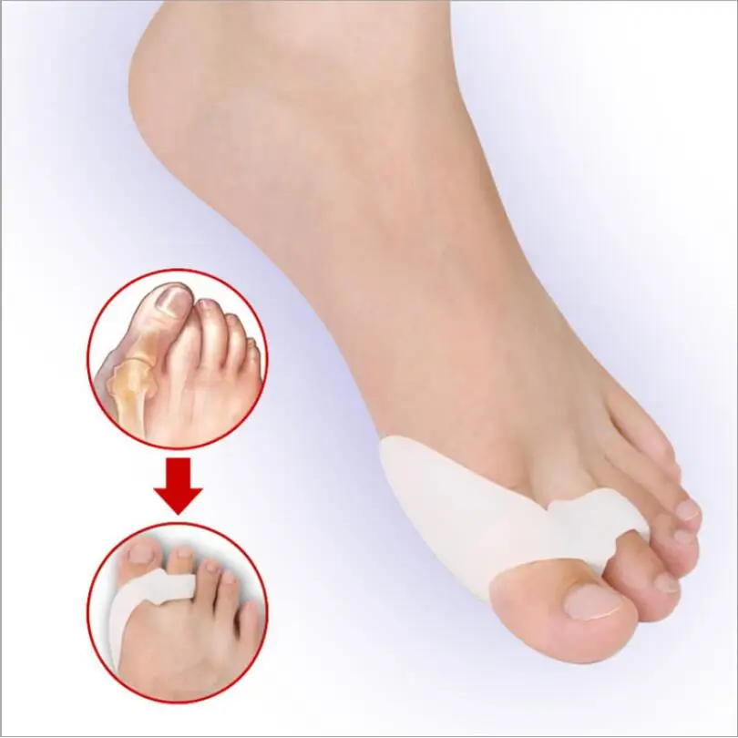 2Pcs Big Toe Straightener Thumb Valgus Protector Silicone Gel Foot Fingers Two Hole Toe Separator Bunion Adjuster Feet T0498