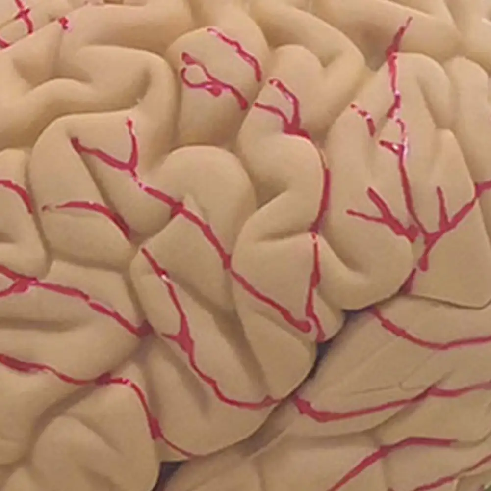 12x11x15 سنتيمتر نموذج الدعائم الطبية تفكيكها التشريحية الإنسان مجسم لشكل مخ 8-جزء بولي كلوريد الفينيل الحياة الحجم التشريح أداة التدريس الطبي