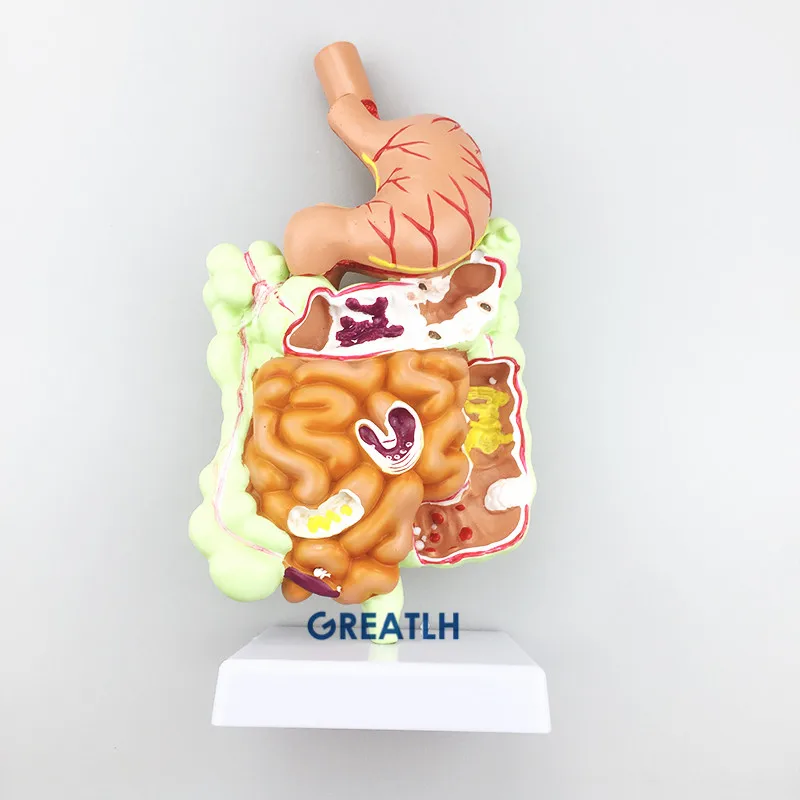 Stomach Large Intestine Cecum Rectal Anatomy Model Human Digestive System Teaching model