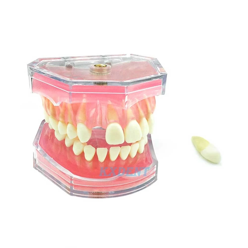 

New 1pcs Dental Study Teaching Model With Removable Teeth Dentistry Standard Model Study Teaching Teeth Model tool