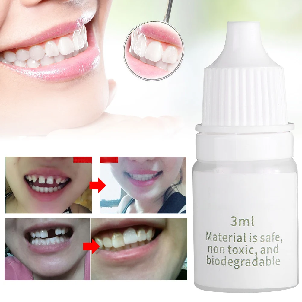 2 Pcs Temporary Tooth Repair Fix Broken Teeth Dental Restoration Fill Missing Teeth Gaps Between Filling Material Dental Repair